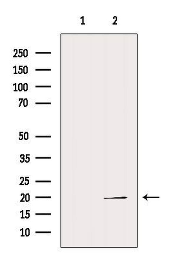 REG3G Antibody in Western Blot (WB)