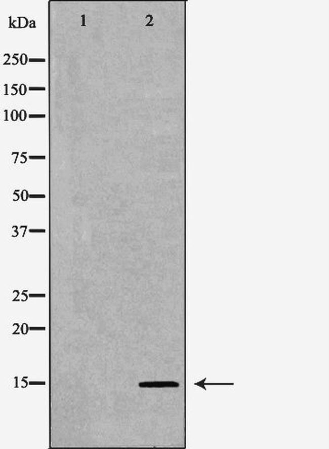 SPINLW1 Antibody in Western Blot (WB)