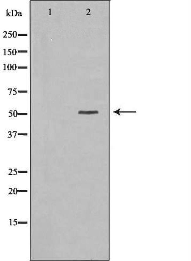 HCLS1 Antibody in Western Blot (WB)