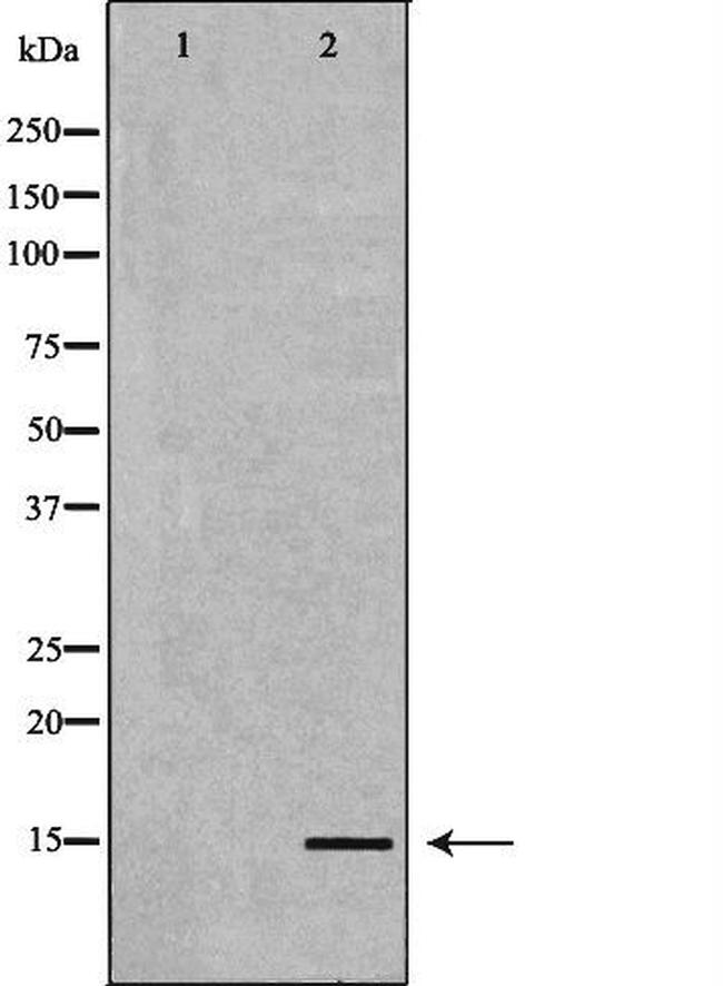 BNP Antibody in Western Blot (WB)