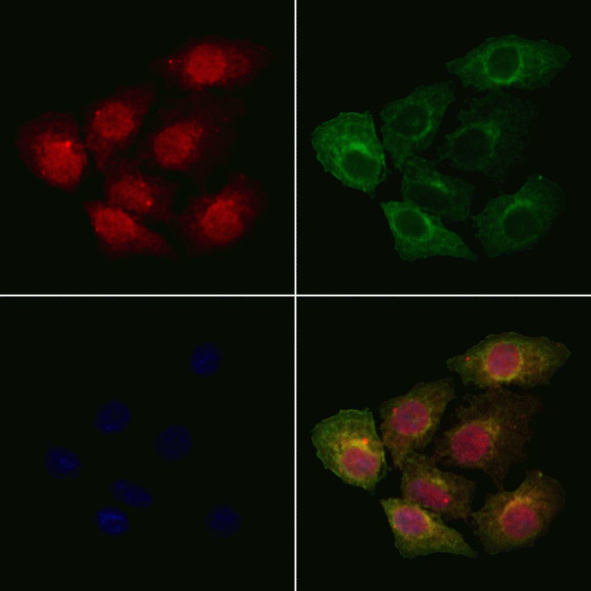 PP1 alpha Antibody in Immunocytochemistry (ICC/IF)