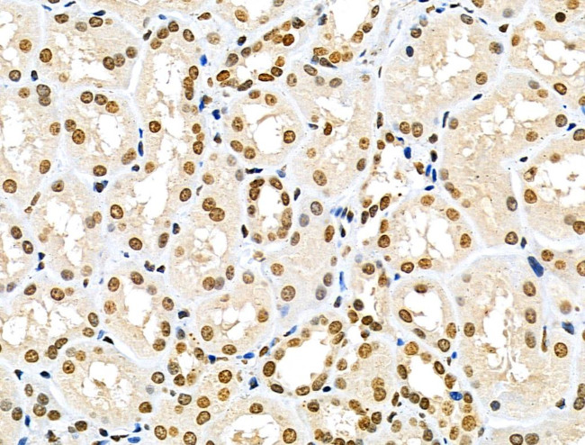 MDA5 Antibody in Immunohistochemistry (Paraffin) (IHC (P))