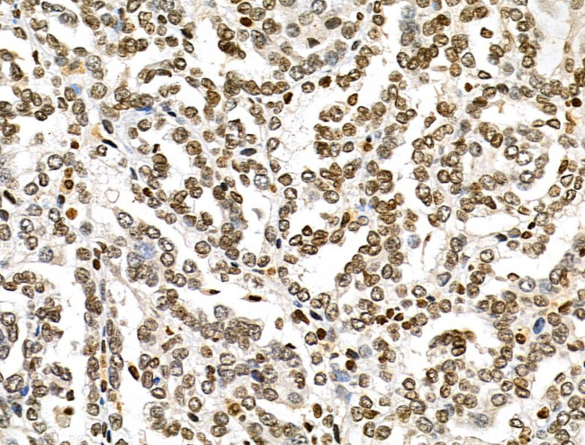 MDA5 Antibody in Immunohistochemistry (Paraffin) (IHC (P))