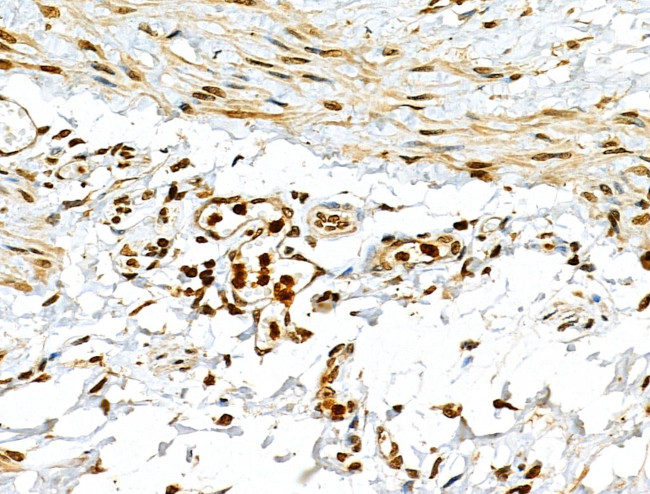 MDA5 Antibody in Immunohistochemistry (Paraffin) (IHC (P))