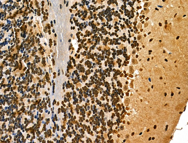 MDA5 Antibody in Immunohistochemistry (Paraffin) (IHC (P))