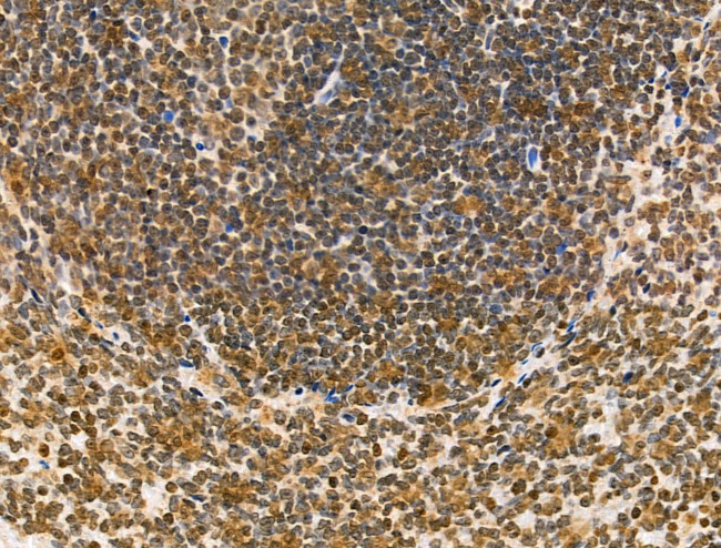 MDA5 Antibody in Immunohistochemistry (Paraffin) (IHC (P))