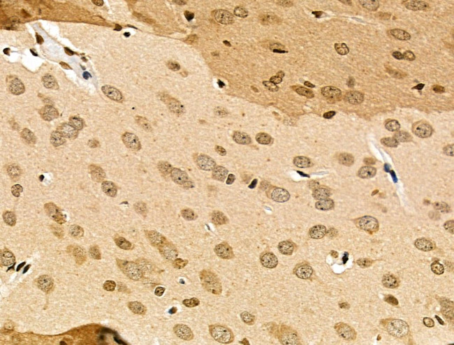 MDA5 Antibody in Immunohistochemistry (Paraffin) (IHC (P))