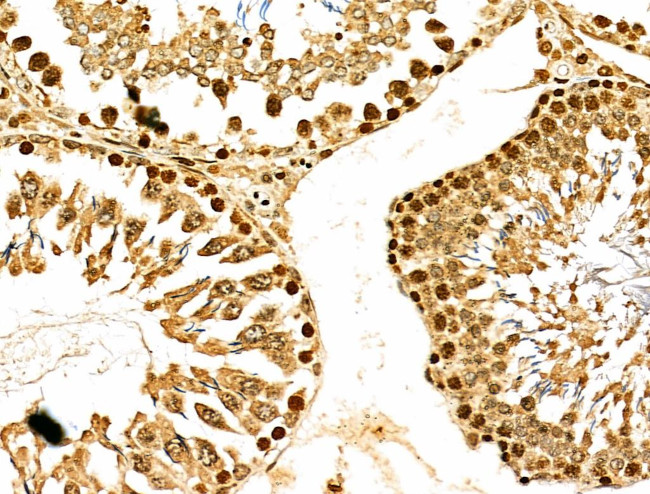 MDA5 Antibody in Immunohistochemistry (Paraffin) (IHC (P))