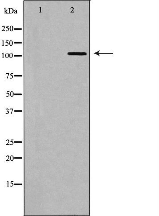 MDA5 Antibody in Western Blot (WB)