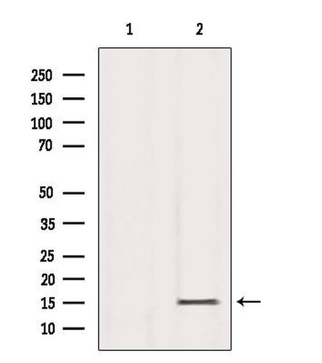 H3K79me3 Antibody in Western Blot (WB)