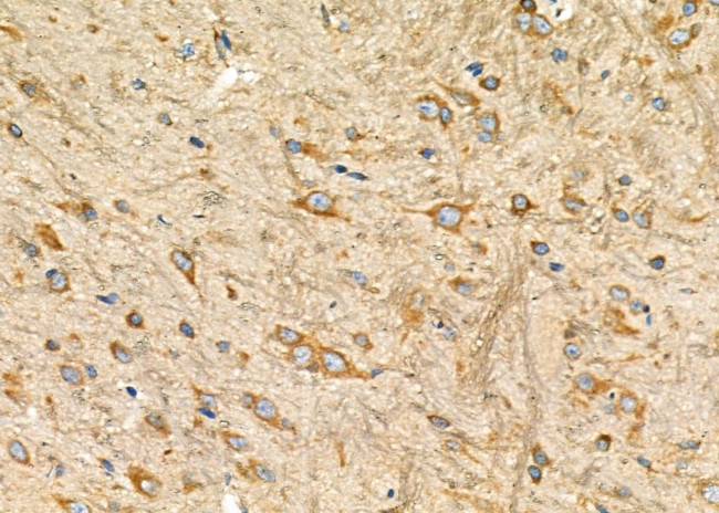 SIAH1 Antibody in Immunohistochemistry (Paraffin) (IHC (P))