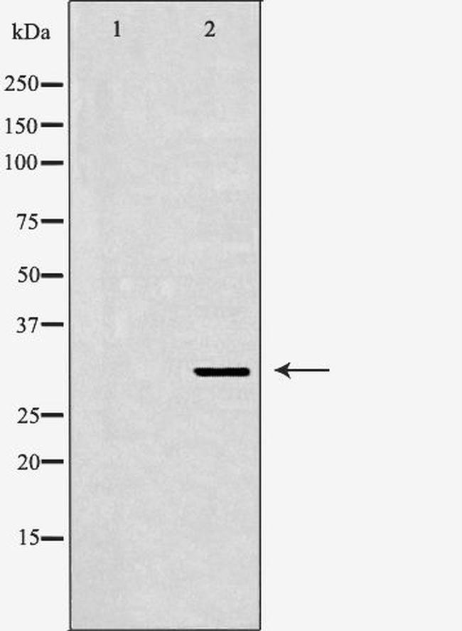 SIAH1 Antibody in Western Blot (WB)