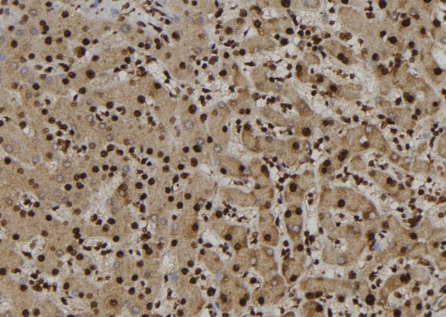 NUP62 Antibody in Immunohistochemistry (Paraffin) (IHC (P))