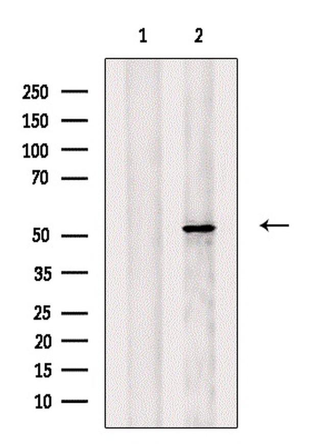 NUP62 Antibody in Western Blot (WB)