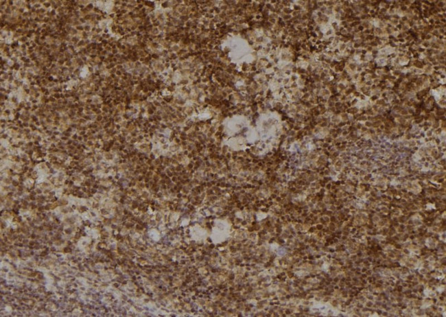 PSMA2 Antibody in Immunohistochemistry (Paraffin) (IHC (P))