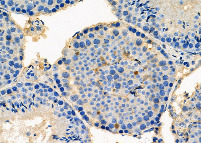 PSMA2 Antibody in Immunohistochemistry (Paraffin) (IHC (P))