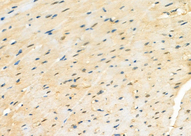 PSMA2 Antibody in Immunohistochemistry (Paraffin) (IHC (P))