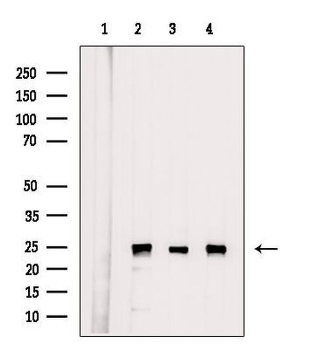 PSMA2 Antibody in Western Blot (WB)