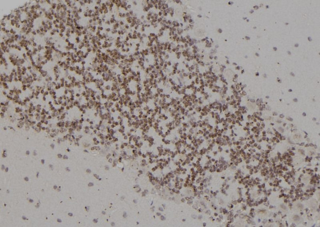 PSMC4 Antibody in Immunohistochemistry (Paraffin) (IHC (P))