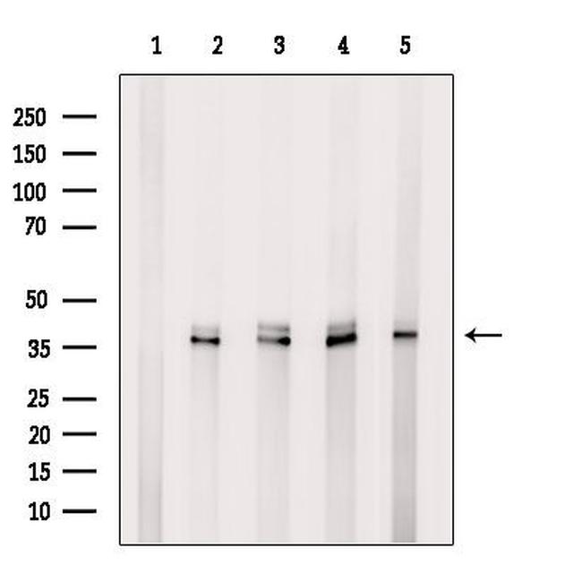 EEF1D Antibody in Western Blot (WB)