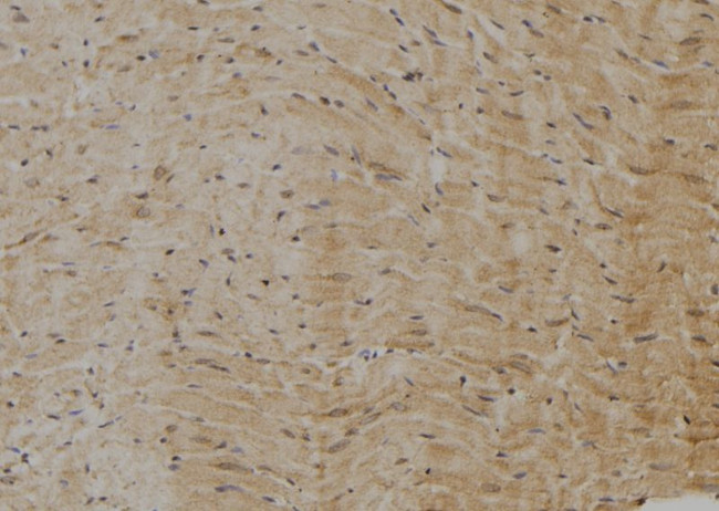 AXIN2 Antibody in Immunohistochemistry (Paraffin) (IHC (P))