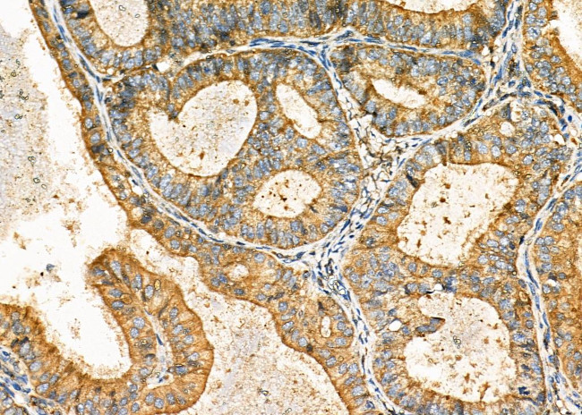 DKK3 Antibody in Immunohistochemistry (Paraffin) (IHC (P))