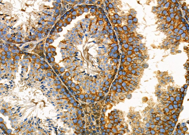 DKK3 Antibody in Immunohistochemistry (Paraffin) (IHC (P))