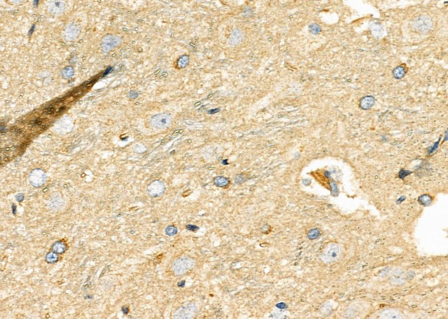 DKK3 Antibody in Immunohistochemistry (Paraffin) (IHC (P))