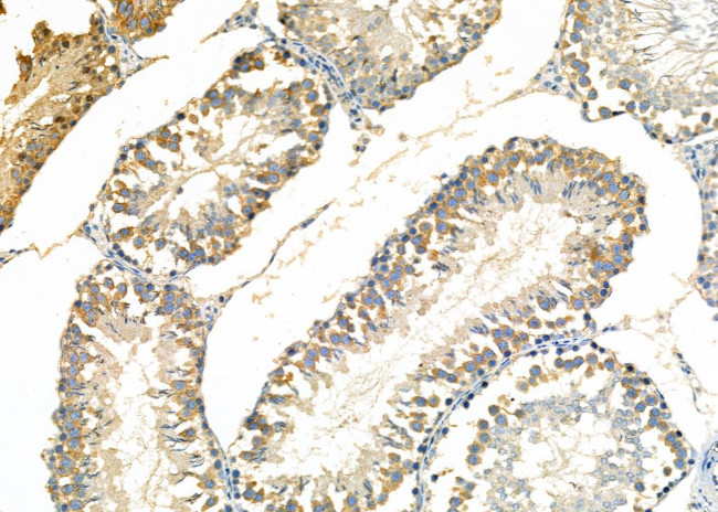 DKK3 Antibody in Immunohistochemistry (Paraffin) (IHC (P))