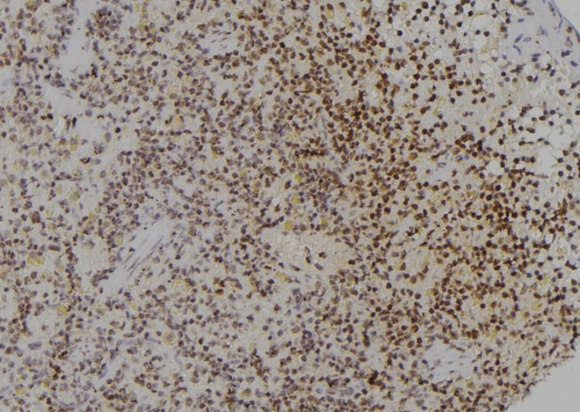 PCBP2 Antibody in Immunohistochemistry (Paraffin) (IHC (P))