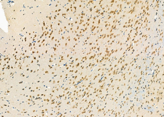 PCBP2 Antibody in Immunohistochemistry (Paraffin) (IHC (P))