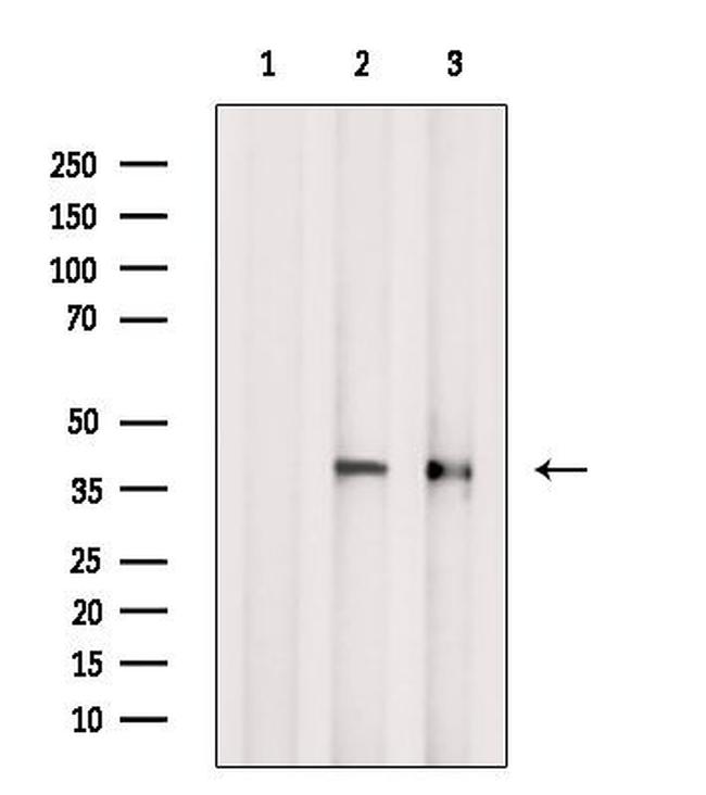 PCBP2 Antibody in Western Blot (WB)