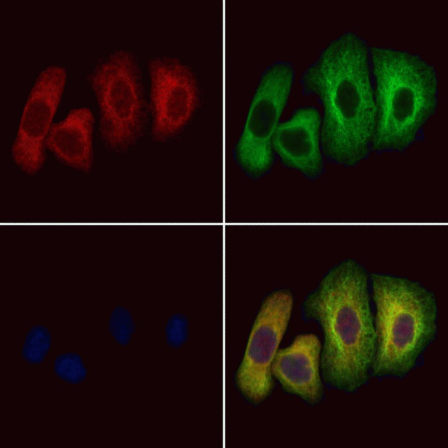 PRG2 Antibody in Immunocytochemistry (ICC/IF)