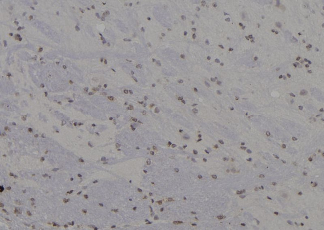 SKP1 Antibody in Immunohistochemistry (Paraffin) (IHC (P))