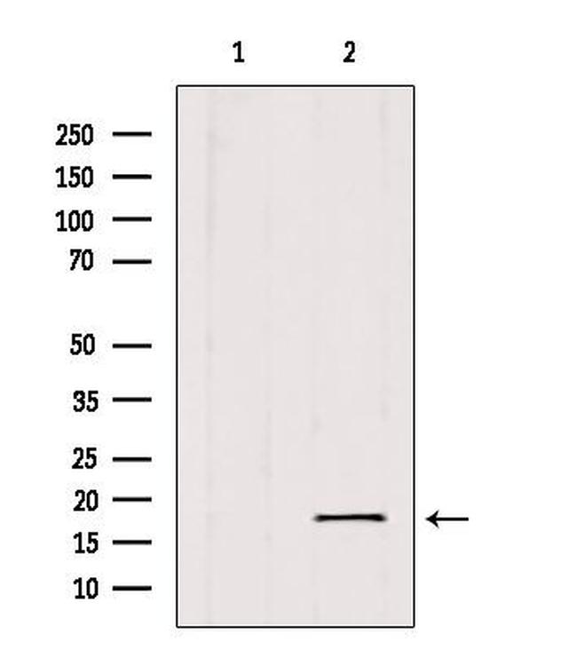 SKP1 Antibody in Western Blot (WB)