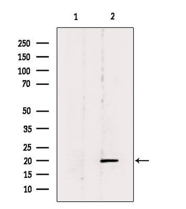 BTC Antibody in Western Blot (WB)