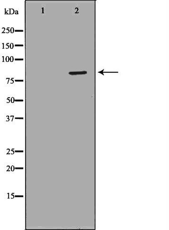 NDUFS1 Antibody in Western Blot (WB)