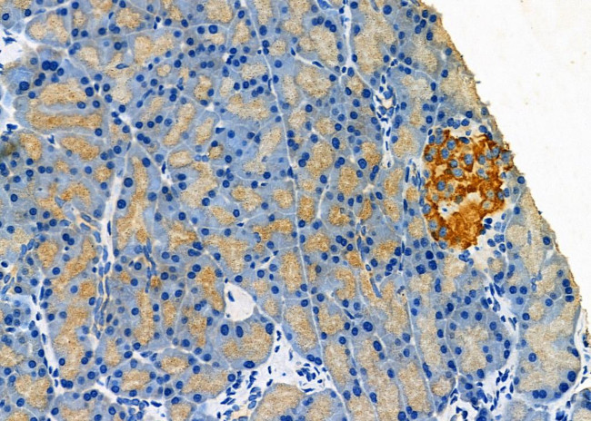 CLEC4D Antibody in Immunohistochemistry (Paraffin) (IHC (P))