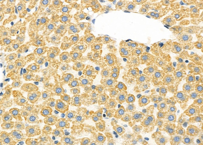 CFHR1 Antibody in Immunohistochemistry (Paraffin) (IHC (P))