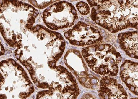 TRAP1 Antibody in Immunohistochemistry (Paraffin) (IHC (P))