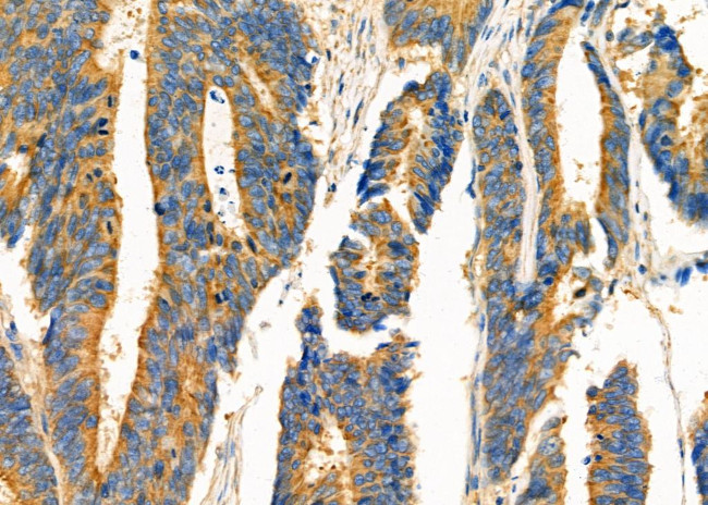 TRAP1 Antibody in Immunohistochemistry (Paraffin) (IHC (P))