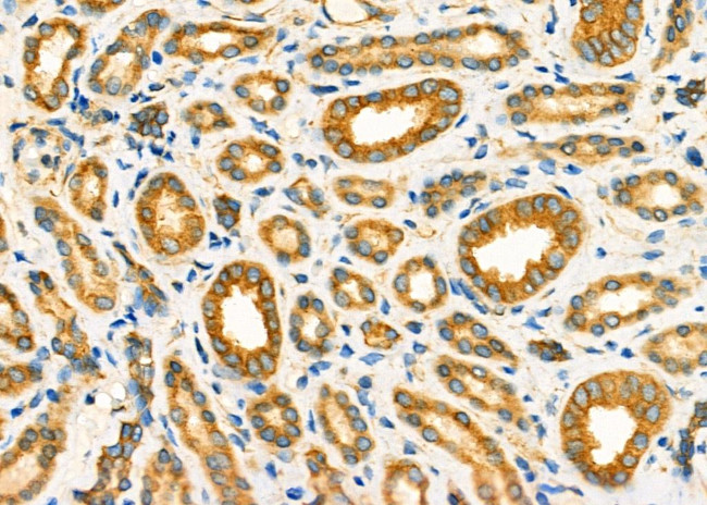 TRAP1 Antibody in Immunohistochemistry (Paraffin) (IHC (P))