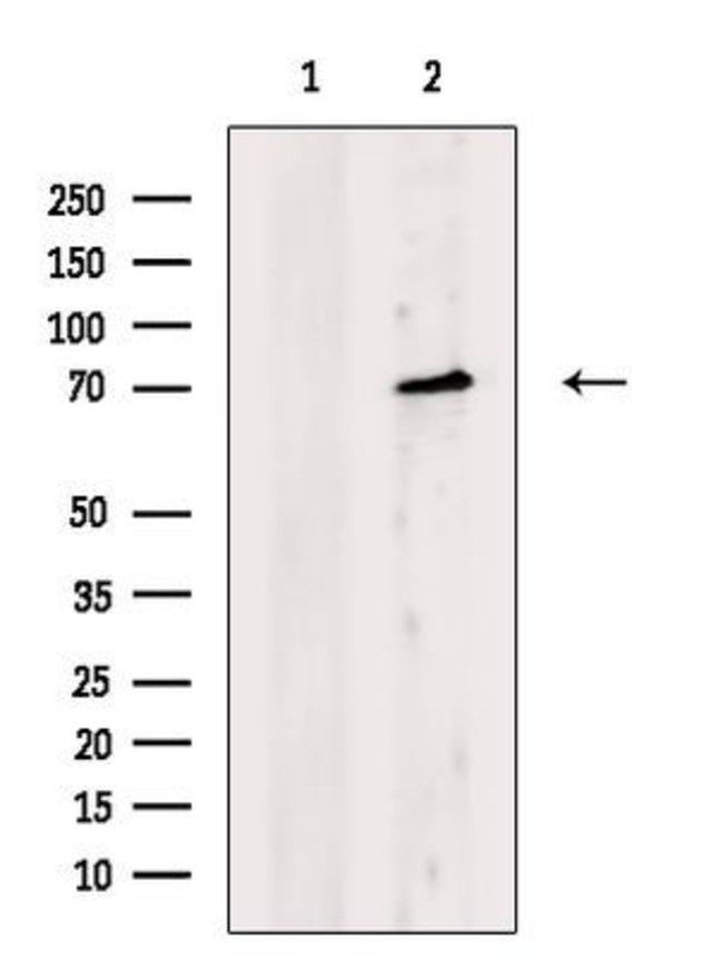 CDH23 Antibody in Western Blot (WB)