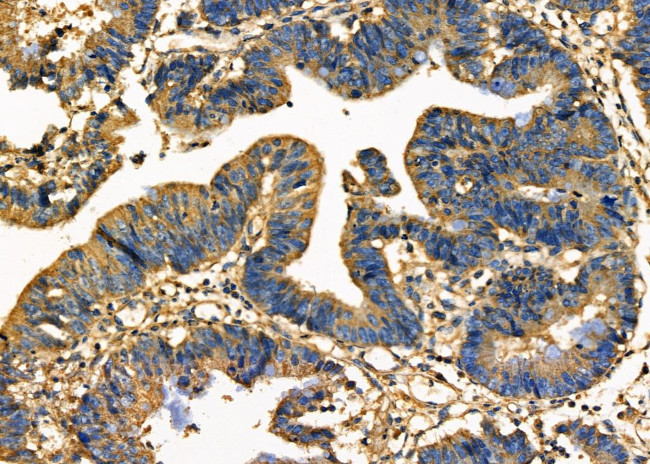 PDCD10 Antibody in Immunohistochemistry (Paraffin) (IHC (P))