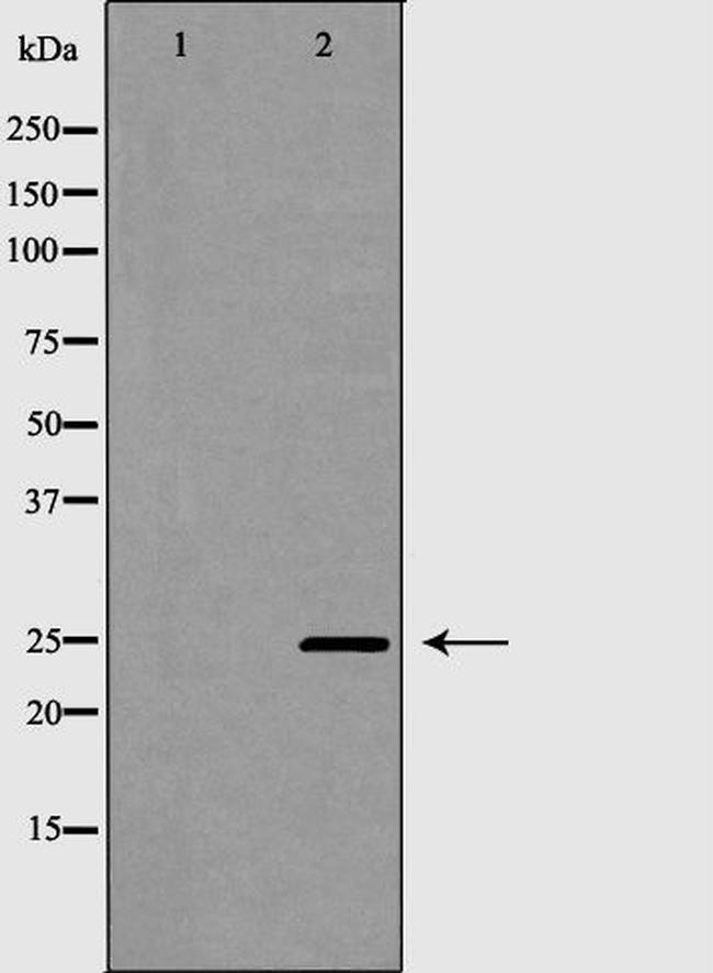 PDCD10 Antibody in Western Blot (WB)