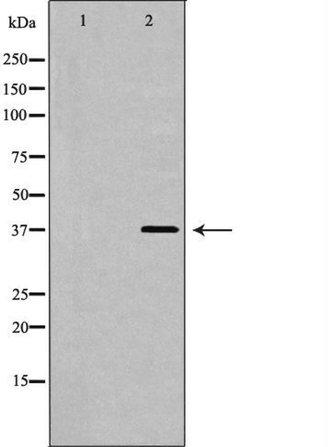 Follistatin Antibody in Western Blot (WB)