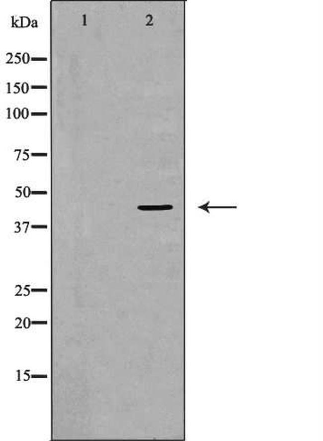 GRPR Antibody in Western Blot (WB)