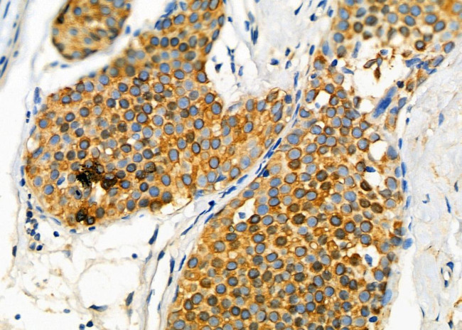 GLRA1 Antibody in Immunohistochemistry (Paraffin) (IHC (P))