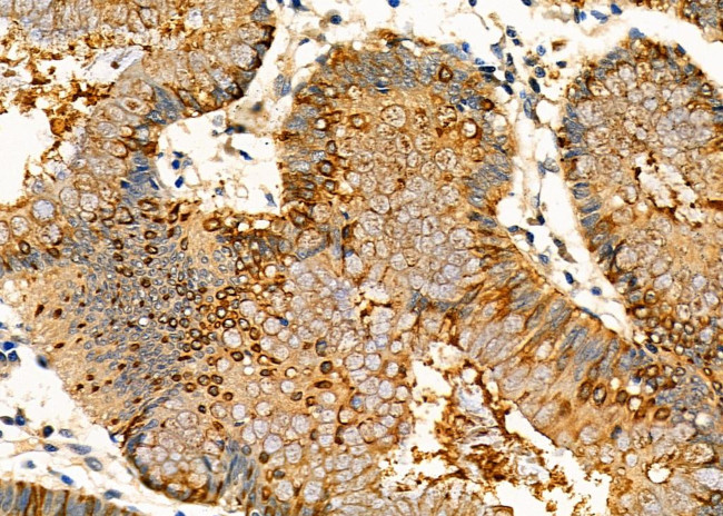 Kallikrein 2 Antibody in Immunohistochemistry (Paraffin) (IHC (P))