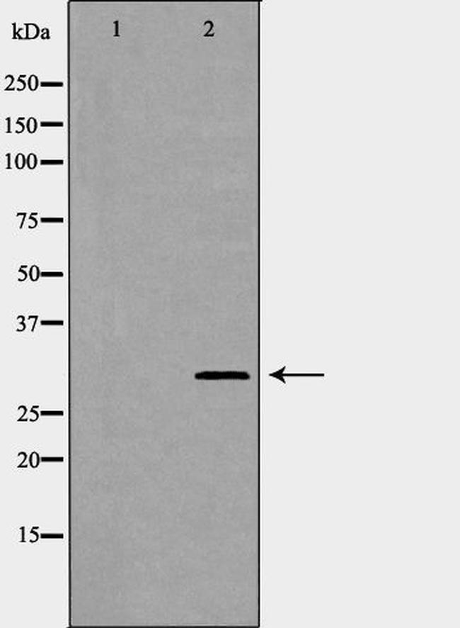 Kallikrein 2 Antibody in Western Blot (WB)